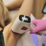 Depilacja laserowa: Jak się przygotować na pierwszą sesję?