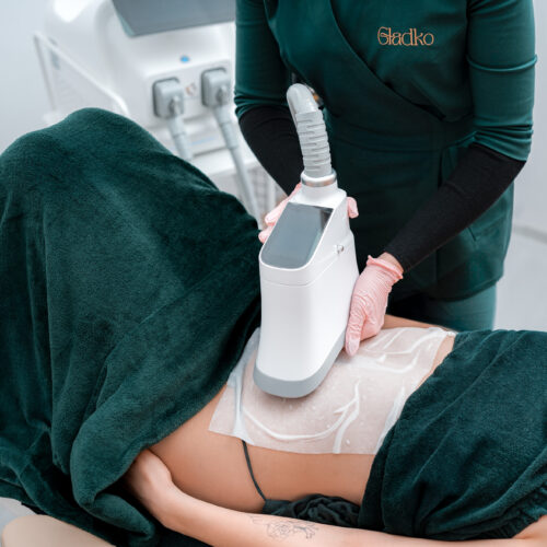 Kriolipoliza – skuteczna redukcja tkanki tłuszczowej bez skalpela